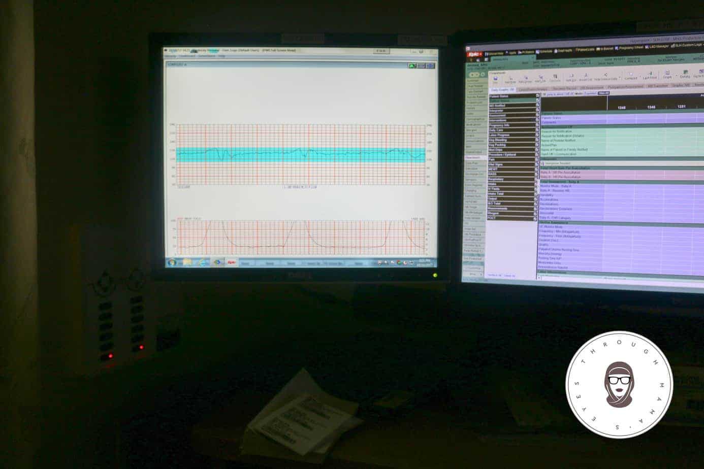 Monitoring My Contractions during my 3rd and last Birth. I share my journey to attempting a Natural Birth after 2 Cesareans (VBA2C) and my experience without supportive doctors. #VBAC #AttemptedVBAC #NAturalBirth #C-section #BirthStory #throughmamaseyes #theBirthhour