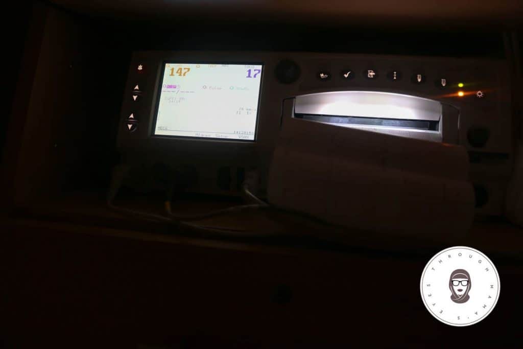 Monitoring My Contractions during my 3rd and last Birth. I share my journey to attempting a Natural Birth after 2 Cesareans (VBA2C) and my experience without supportive doctors. #VBAC #AttemptedVBAC #NAturalBirth #C-section #BirthStory #throughmamaseyes #theBirthhour